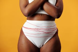 woman in panty with rope tied around depicting pcos or endometriosis